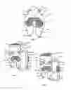 Fig. 02 - Resilient knee implant and methods