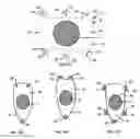 Fig. 07 - Resilient knee implant and methods
