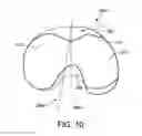 Fig. 09 - Knee implant system