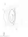 Fig. 02 - Prosthesis for joint shoulder reconstruction