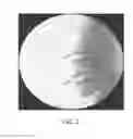 Fig. 08 - Polyaryletherketone artificial intervertebral disc