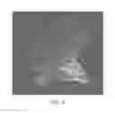 Fig. 09 - Polyaryletherketone artificial intervertebral disc