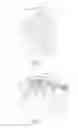 Fig. 02 - EXPANDABLE INTERBODY IMPLANT