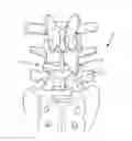 Fig. 01 - Spinal implant system and method