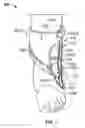 Fig. 06 - STABILIZING ANKLE BRACE