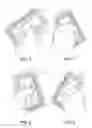 Fig. 07 - Flexible instrument for soft tissue mobilization