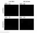 Fig. 06 - METHOD FOR TREATING CANCER BASED ON LEVEL OF GLUCOCORTICOID RECEPTOR