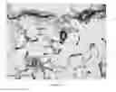 Fig. 09 - Method of treating pulmonary arterial hypertension