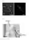 Fig. 02 - Mouse with D4R iRNA in the intercalating cell mass of the amygdala