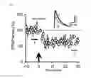 Fig. 07 - Mouse with D4R iRNA in the intercalating cell mass of the amygdala