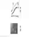 Fig. 07 - SHEAR CONTROLLED RELEASE FOR STENOTIC LESIONS AND THROMBOLYTIC THERAPIES