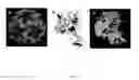 Fig. 04 - Immunogenic Human Rhinovirus (HRV) Composition