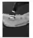 Fig. 01 - HEMOSTATIC PASTE WITH LIGHT-CURABLE FEATURE