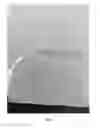 Fig. 03 - HEMOSTATIC PASTE WITH LIGHT-CURABLE FEATURE