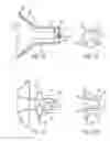 Fig. 07 - Highly efficient breastpump and system for expressing breastmilk