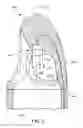 Fig. 07 - Integrated sensors for intraventricular VAD