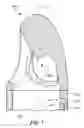 Fig. 08 - Integrated sensors for intraventricular VAD
