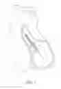 Fig. 04 - Sheath assembly for catheter pump