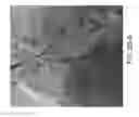 Fig. 14 - Sheath assembly for catheter pump