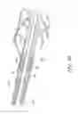 Fig. 18 - Sheath assembly for catheter pump