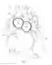 Fig. 02 - Artificial Ventricles