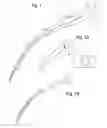 Fig. 02 - DEVICES, SYSTEMS AND METHODS FOR IMPROVED INTUBATION AND MANAGEMENT OF AIRWAYS
