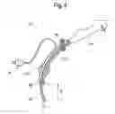 Fig. 09 - DEVICES, SYSTEMS AND METHODS FOR IMPROVED INTUBATION AND MANAGEMENT OF AIRWAYS