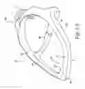 Fig. 06 - Delivery of respiratory therapy