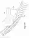 Fig. 16 - Delivery of respiratory therapy