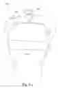 Fig. 26 - Delivery of respiratory therapy
