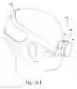 Fig. 34 - Delivery of respiratory therapy