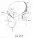 Fig. 43 - Delivery of respiratory therapy
