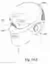 Fig. 48 - Delivery of respiratory therapy