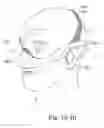 Fig. 52 - Delivery of respiratory therapy