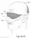 Fig. 56 - Delivery of respiratory therapy