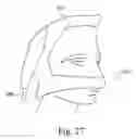 Fig. 76 - Delivery of respiratory therapy