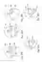 Fig. 79 - Delivery of respiratory therapy