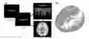 Fig. 01 - METHOD OF CORRELATING BRAIN ACTIVITY