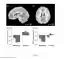 Fig. 02 - METHOD OF CORRELATING BRAIN ACTIVITY