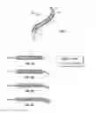 Fig. 02 - SHAPE-TRANSFERRING CANNULA SYSTEM AND METHOD OF USE