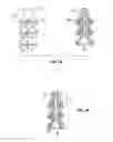 Fig. 04 - SHAPE-TRANSFERRING CANNULA SYSTEM AND METHOD OF USE
