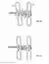 Fig. 10 - SHAPE-TRANSFERRING CANNULA SYSTEM AND METHOD OF USE