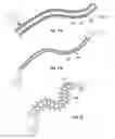 Fig. 17 - SHAPE-TRANSFERRING CANNULA SYSTEM AND METHOD OF USE