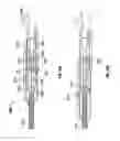 Fig. 27 - SHAPE-TRANSFERRING CANNULA SYSTEM AND METHOD OF USE
