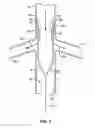 Fig. 04 - Method and Apparatus for Intra-Aortic Substance Delivery to a Branch Vessel