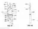 Fig. 28 - Method and Apparatus for Intra-Aortic Substance Delivery to a Branch Vessel