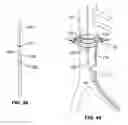 Fig. 32 - Method and Apparatus for Intra-Aortic Substance Delivery to a Branch Vessel