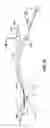 Fig. 40 - Method and Apparatus for Intra-Aortic Substance Delivery to a Branch Vessel