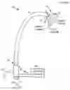 Fig. 01 - Transseptal access device and method of use