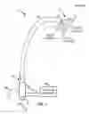 Fig. 02 - Transseptal access device and method of use